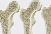 Giornata dell'osteoporosi | Farmacia Gamba